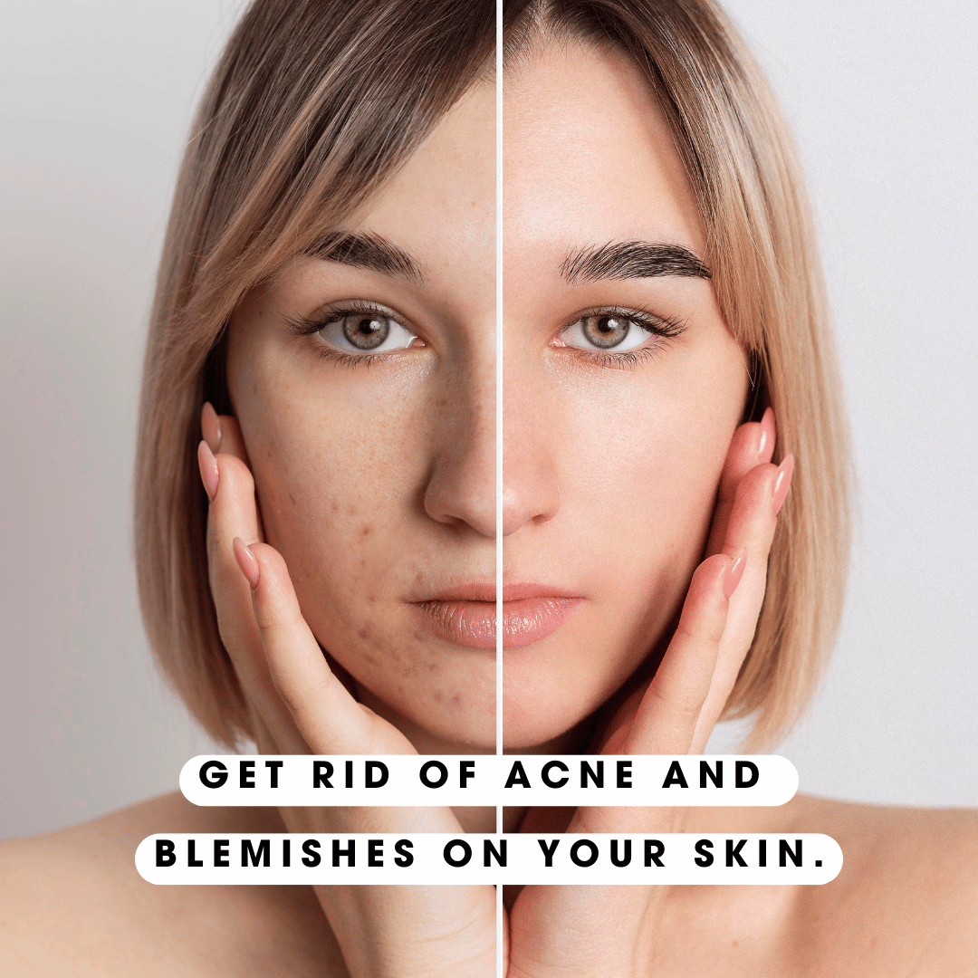 CapiLume FaceLift Pro™ – Instant Refresh, Visible Lift