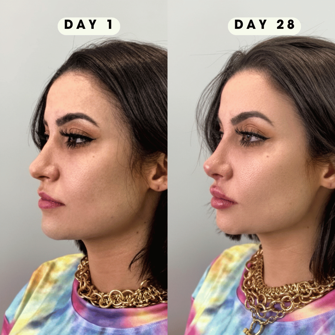 CapiLume FaceLift Pro™ – Instant Refresh, Visible Lift