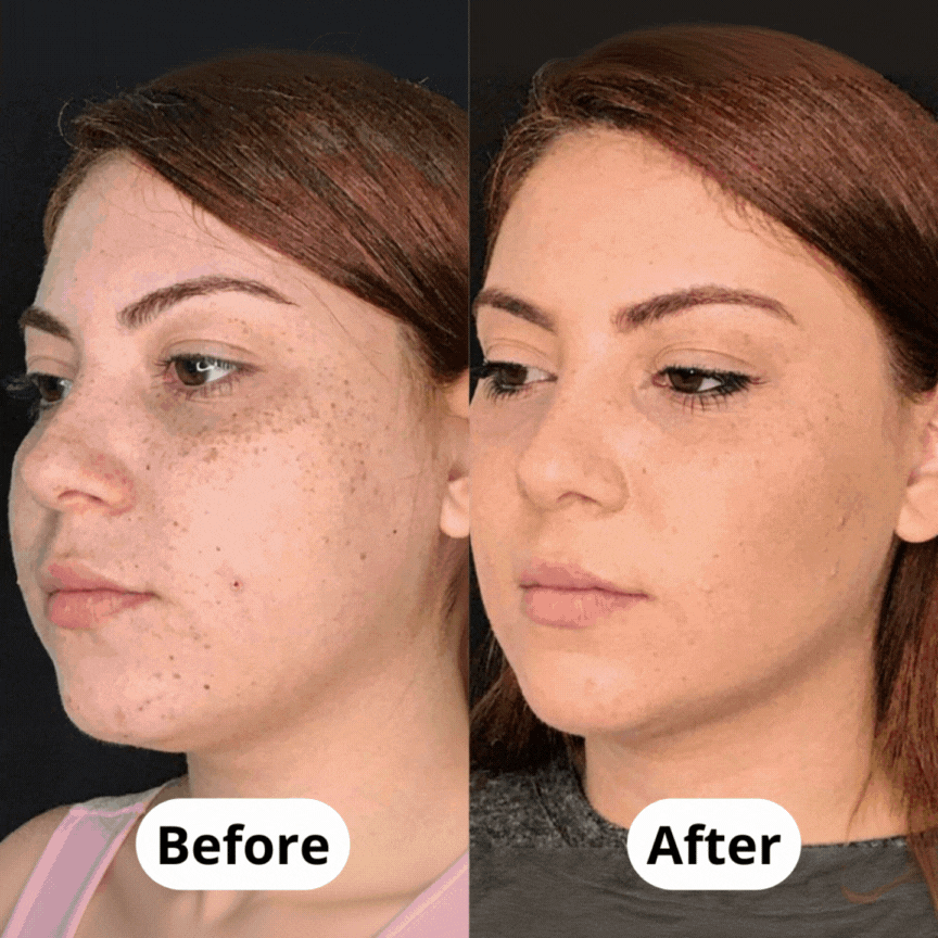 CapiLume FaceLift Pro™ – Instant Refresh, Visible Lift